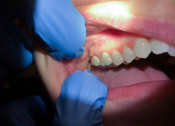 Best Cosmetic Emergency Dentistry in Montgomery Village, MD