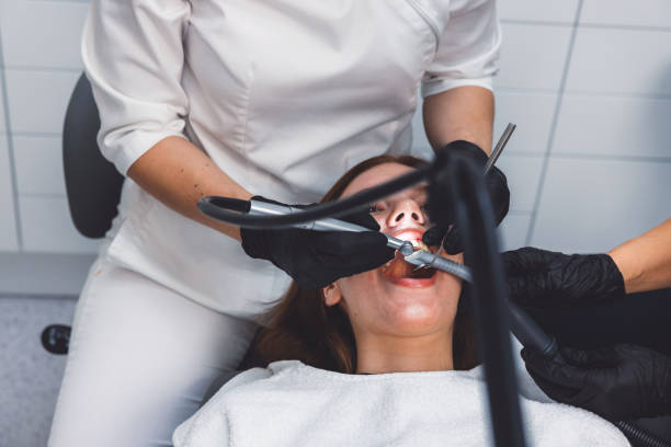 Best Emergency Root Canal Treatment in Montgomery Village, MD